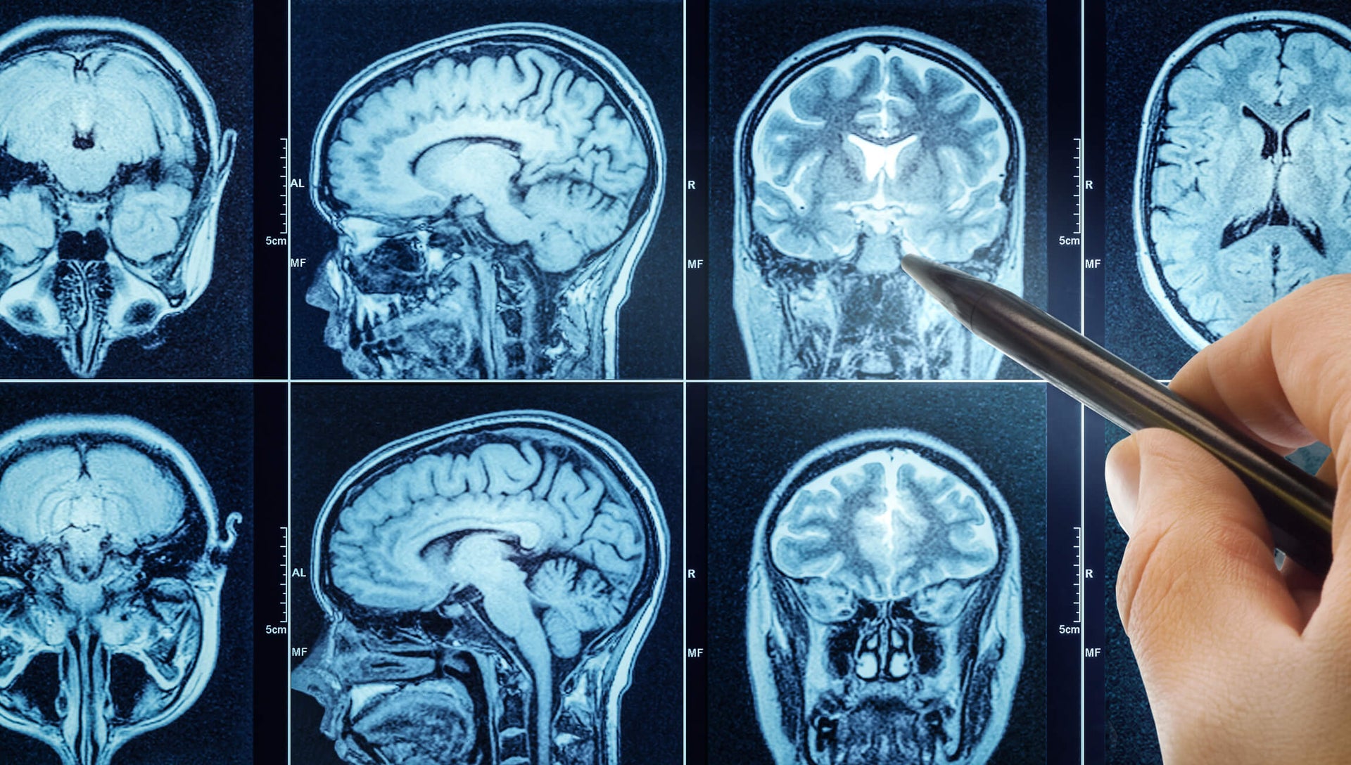What 300 000 Brain Scans Have Taught Us About Mental Health Amen what-300-000-brain-scans-have-taught-us-about-mental-health-amen